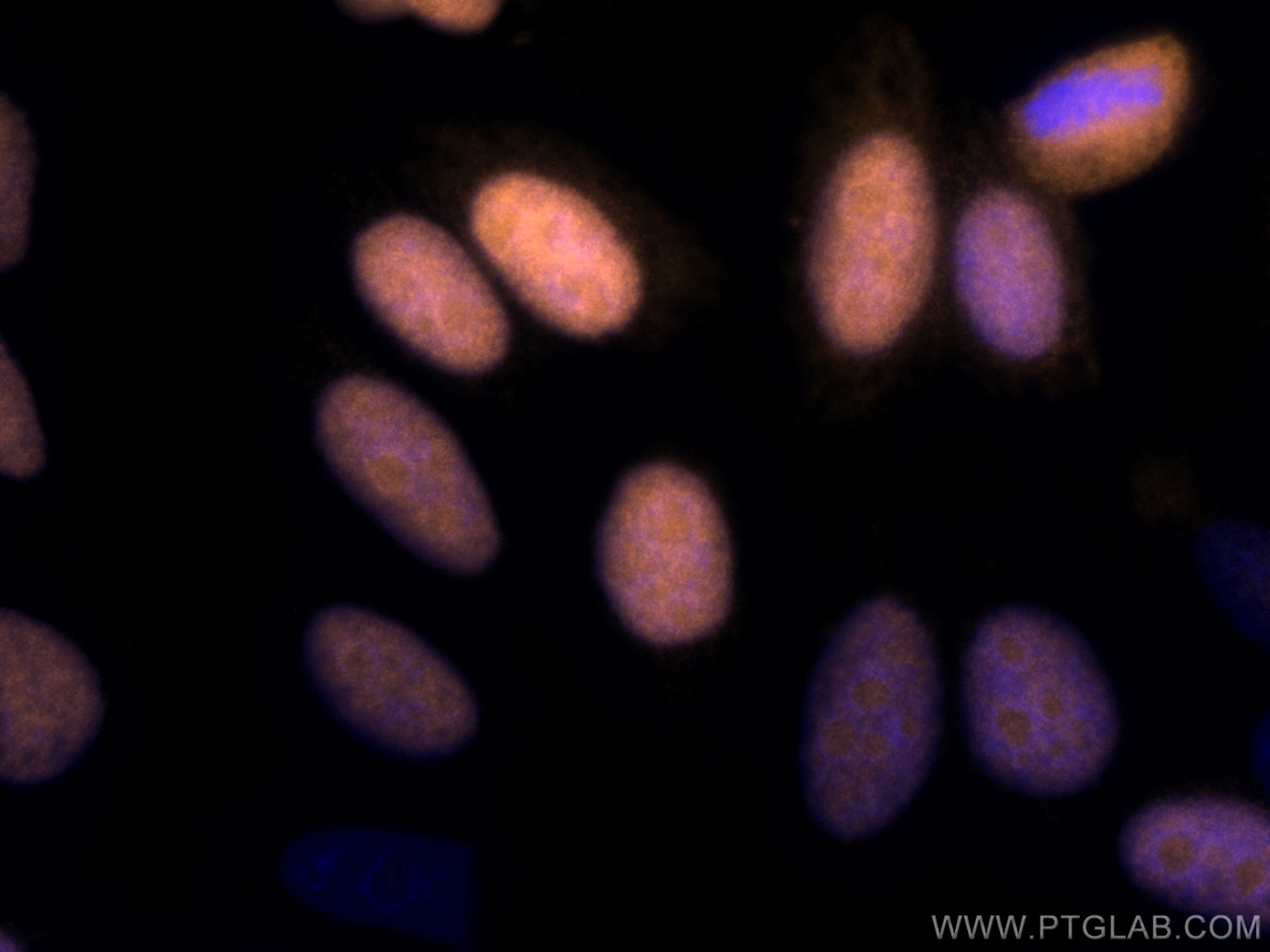 Immunofluorescence (IF) / fluorescent staining of HepG2 cells using CoraLite®555-conjugated Geminin Polyclonal antibod (CL555-10802)