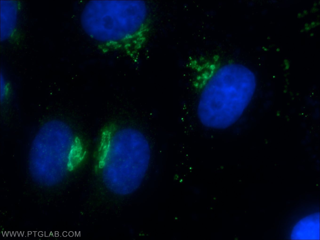 Immunofluorescence (IF) / fluorescent staining of HepG2 cells using Giantin Polyclonal antibody (22270-1-AP)