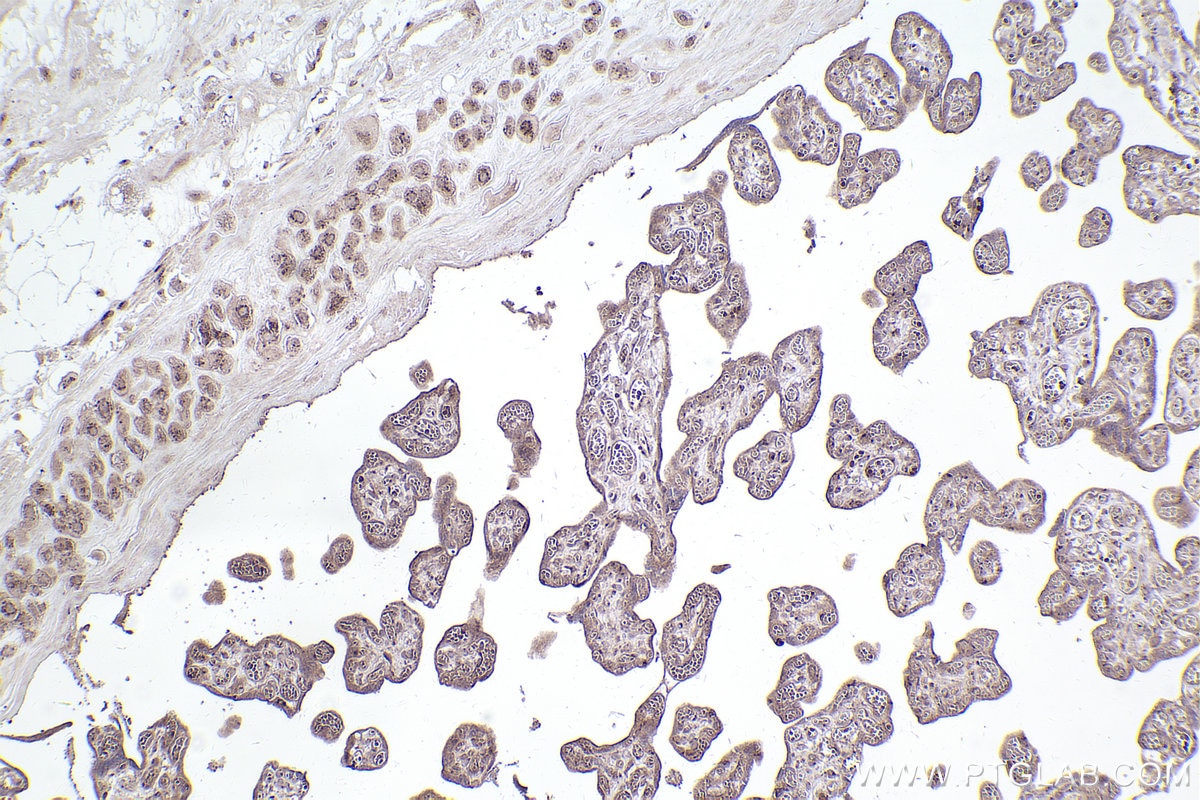 IHC staining of human placenta using 22270-1-AP Immunohistochemistry (IHC) staining of human placenta tissue using Giantin Polyclonal antibody (22270-1-AP)