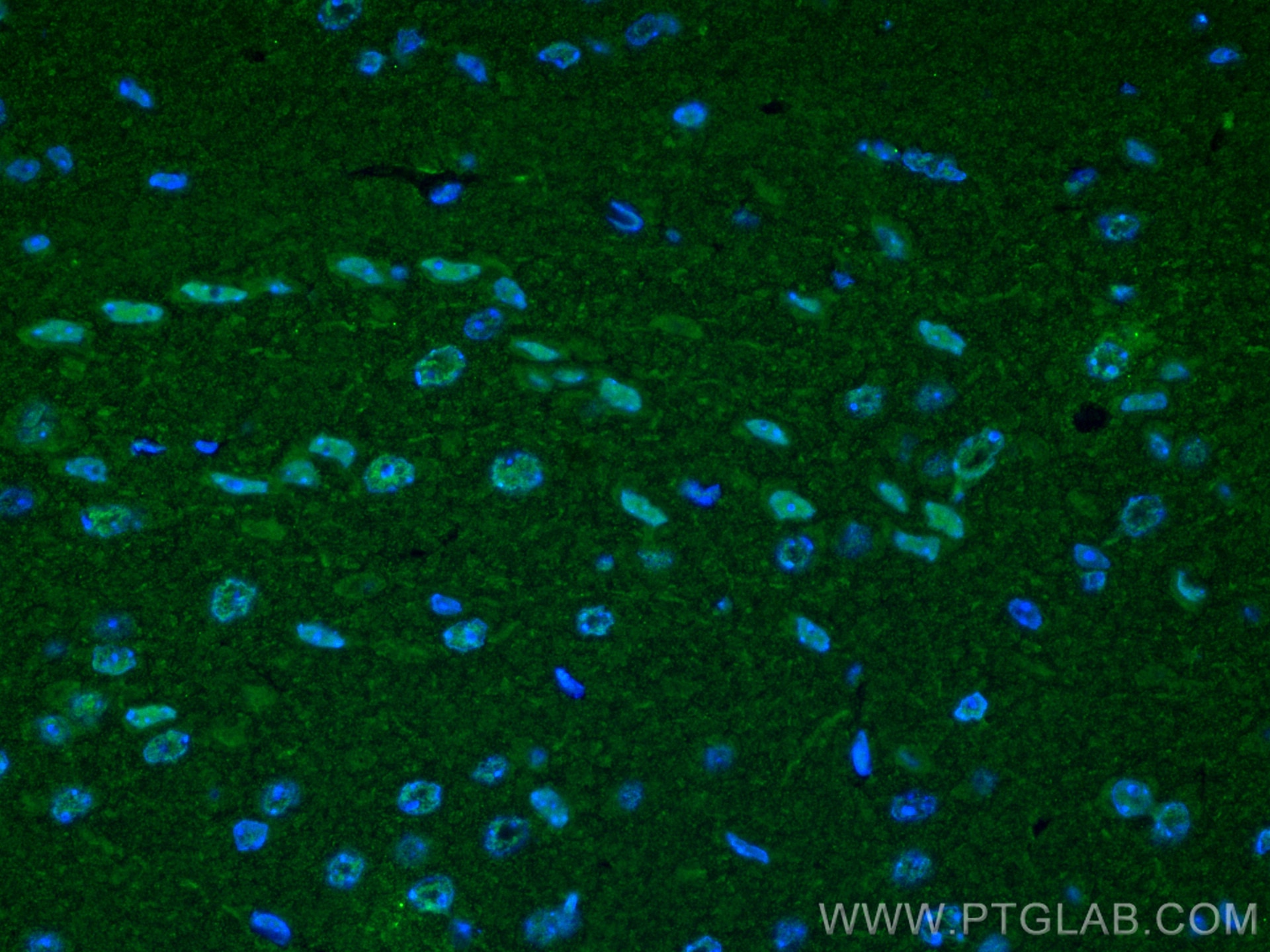 Immunofluorescence (IF) / fluorescent staining of mouse brain tissue using Glucocorticoid receptor Monoclonal antibody (66904-1-Ig)