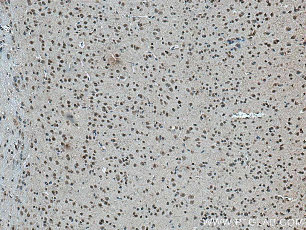 IHC staining of mouse brain using 66904-1-Ig