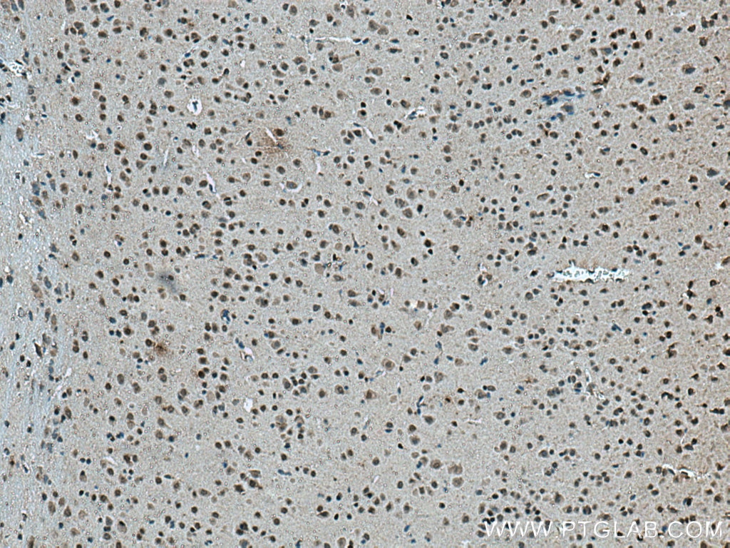 Immunohistochemistry (IHC) staining of mouse brain tissue using Glucocorticoid receptor Monoclonal antibody (66904-1-Ig)