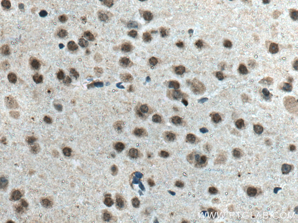 Immunohistochemistry (IHC) staining of mouse brain tissue using Glucocorticoid receptor Monoclonal antibody (66904-1-Ig)