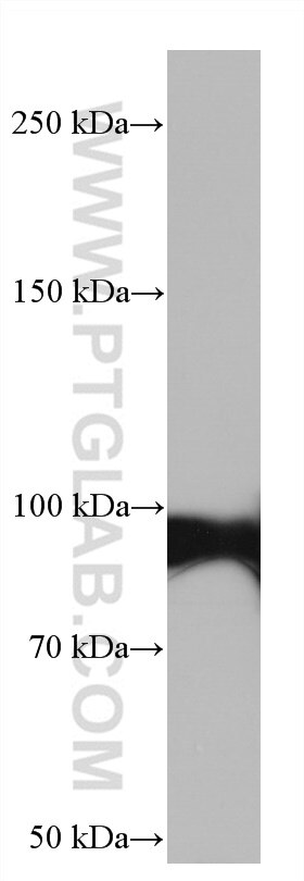 Western Blot (WB) analysis of Jurkat cells using Glucocorticoid receptor Monoclonal antibody (66904-1-Ig)