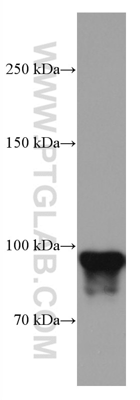 Western Blot (WB) analysis of HeLa cells using Glucocorticoid receptor Monoclonal antibody (66904-1-Ig)