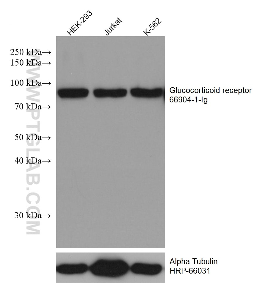 Western Blot (WB) analysis of various lysates using Glucocorticoid receptor Monoclonal antibody (66904-1-Ig)