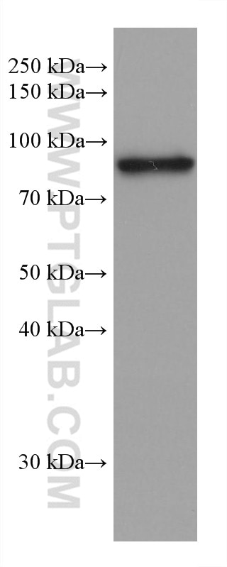 WB analysis of 4T1 using 66904-1-Ig