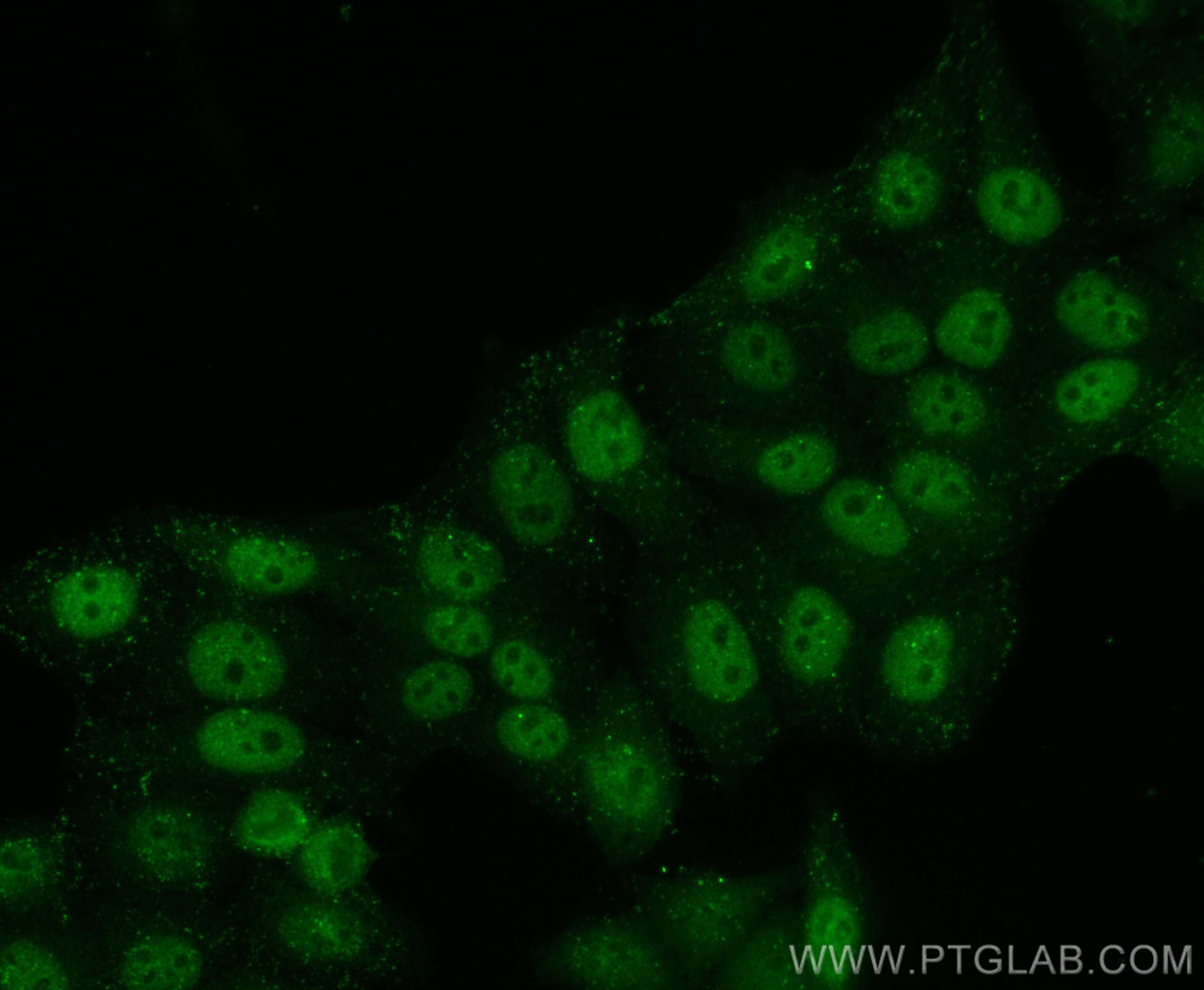 Immunofluorescence (IF) / fluorescent staining of HepG2 cells using Glucocorticoid receptor Recombinant antibody (82619-4-RR)