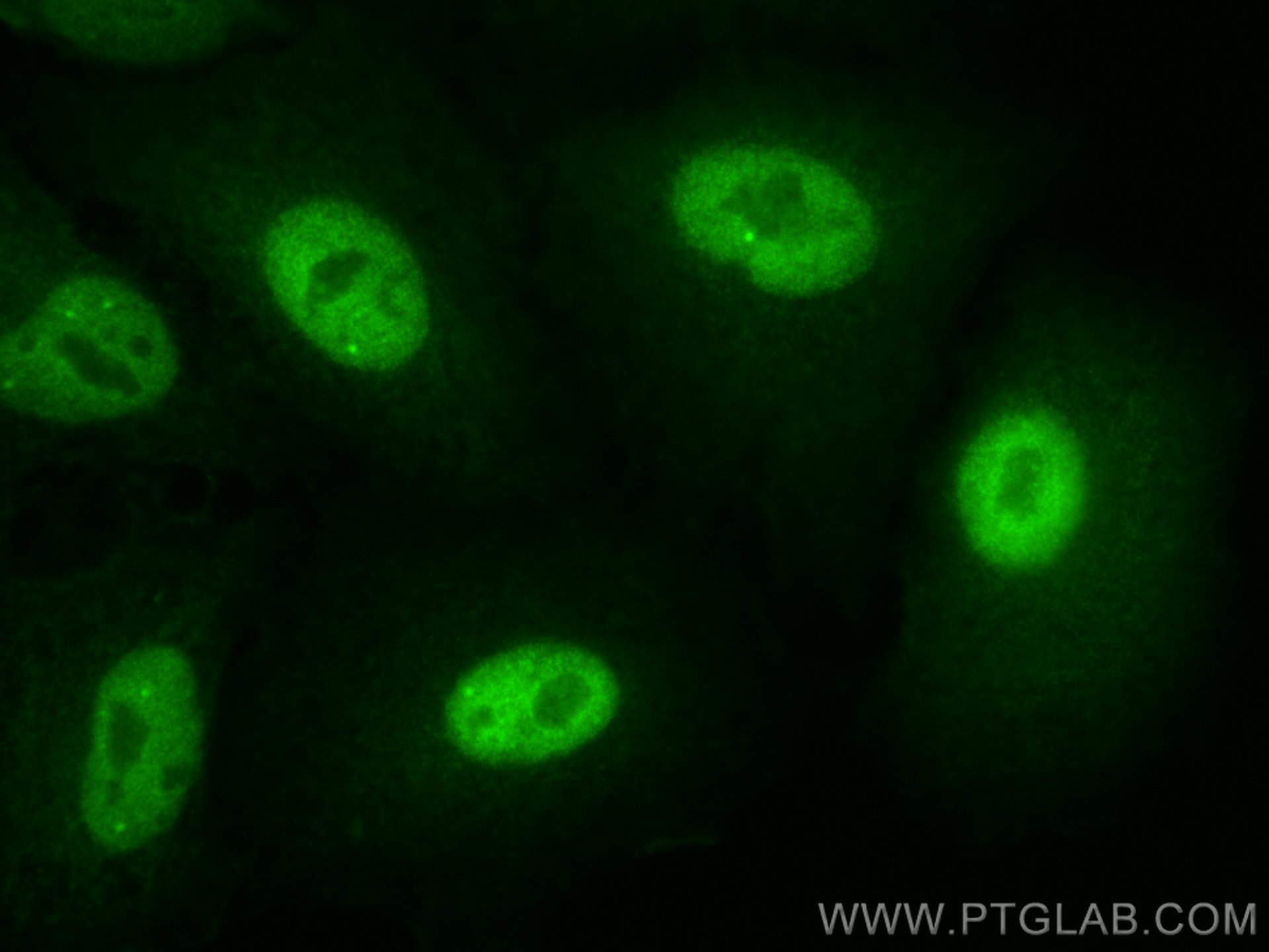 Immunofluorescence (IF) / fluorescent staining of A549 cells using CoraLite® Plus 488-conjugated Glucocorticoid recep (CL488-24050)