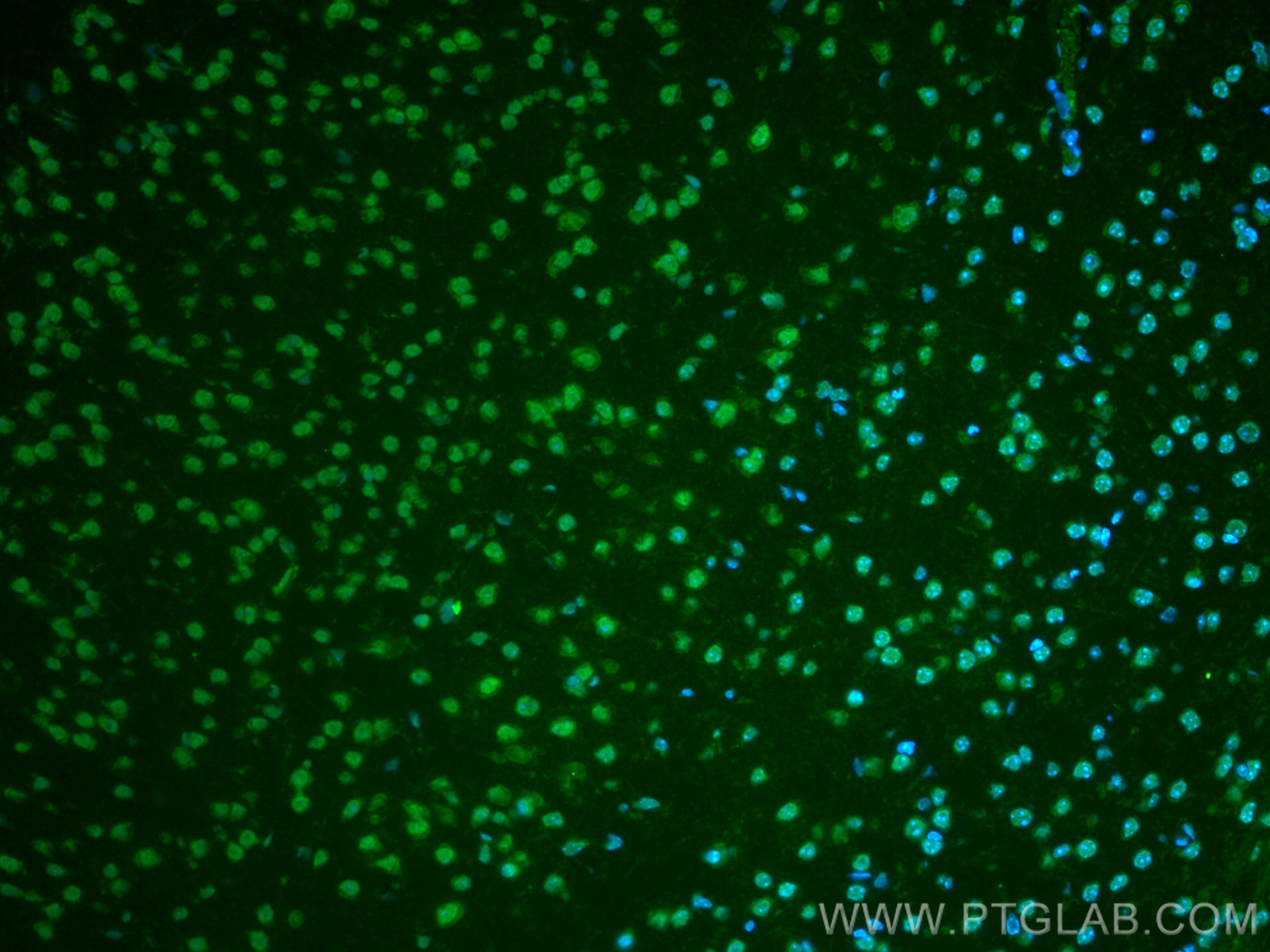 Immunofluorescence (IF) / fluorescent staining of mouse brain tissue using CoraLite® Plus 488-conjugated Glucocorticoid recep (CL488-66904)