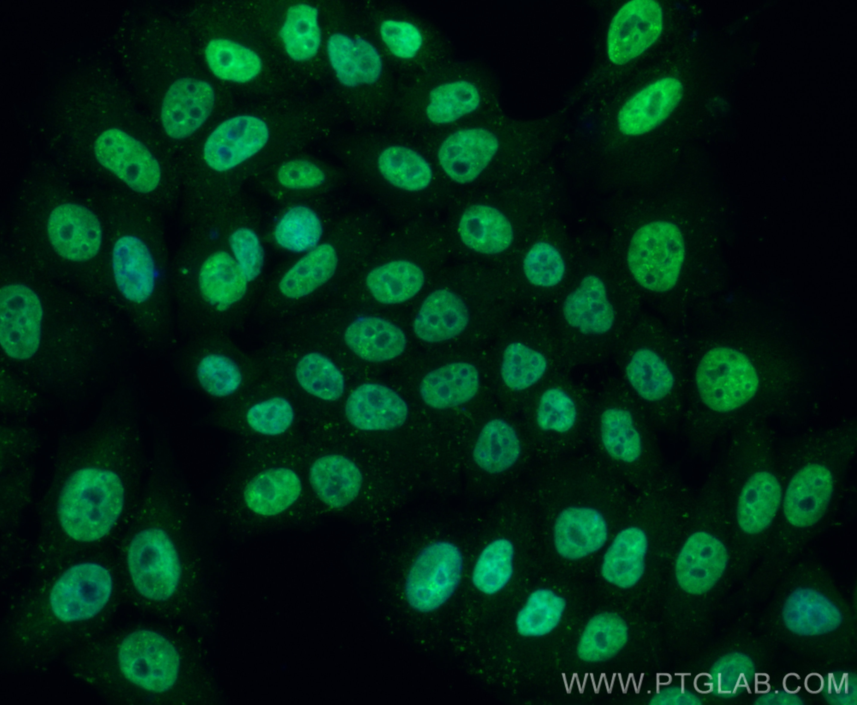 Immunofluorescence (IF) / fluorescent staining of HepG2 cells using CoraLite® Plus 488-conjugated Glucocorticoid recep (CL488-82619-4)