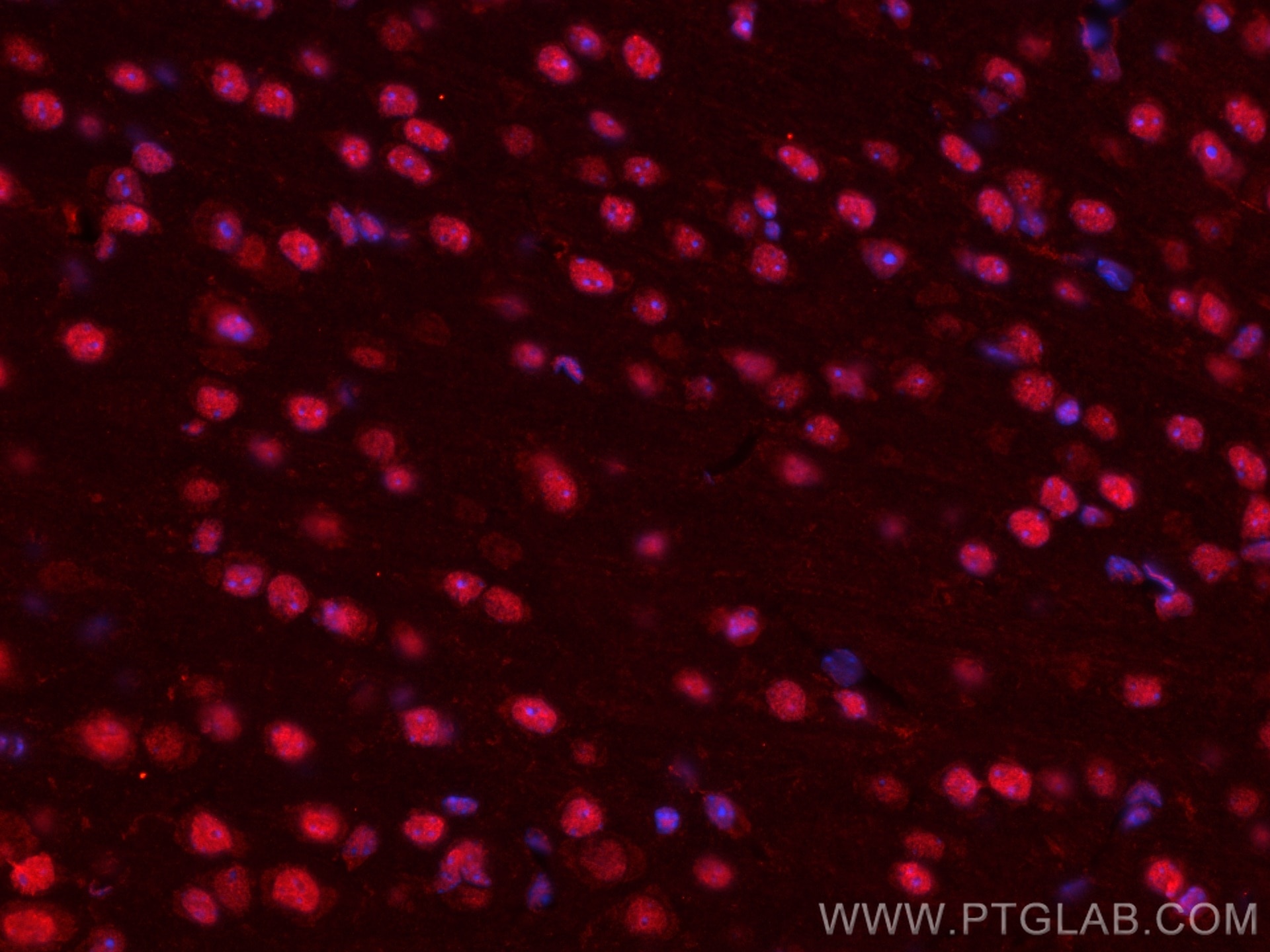 Immunofluorescence (IF) / fluorescent staining of mouse brain tissue using CoraLite®594-conjugated Glucocorticoid receptor Mo (CL594-66904)