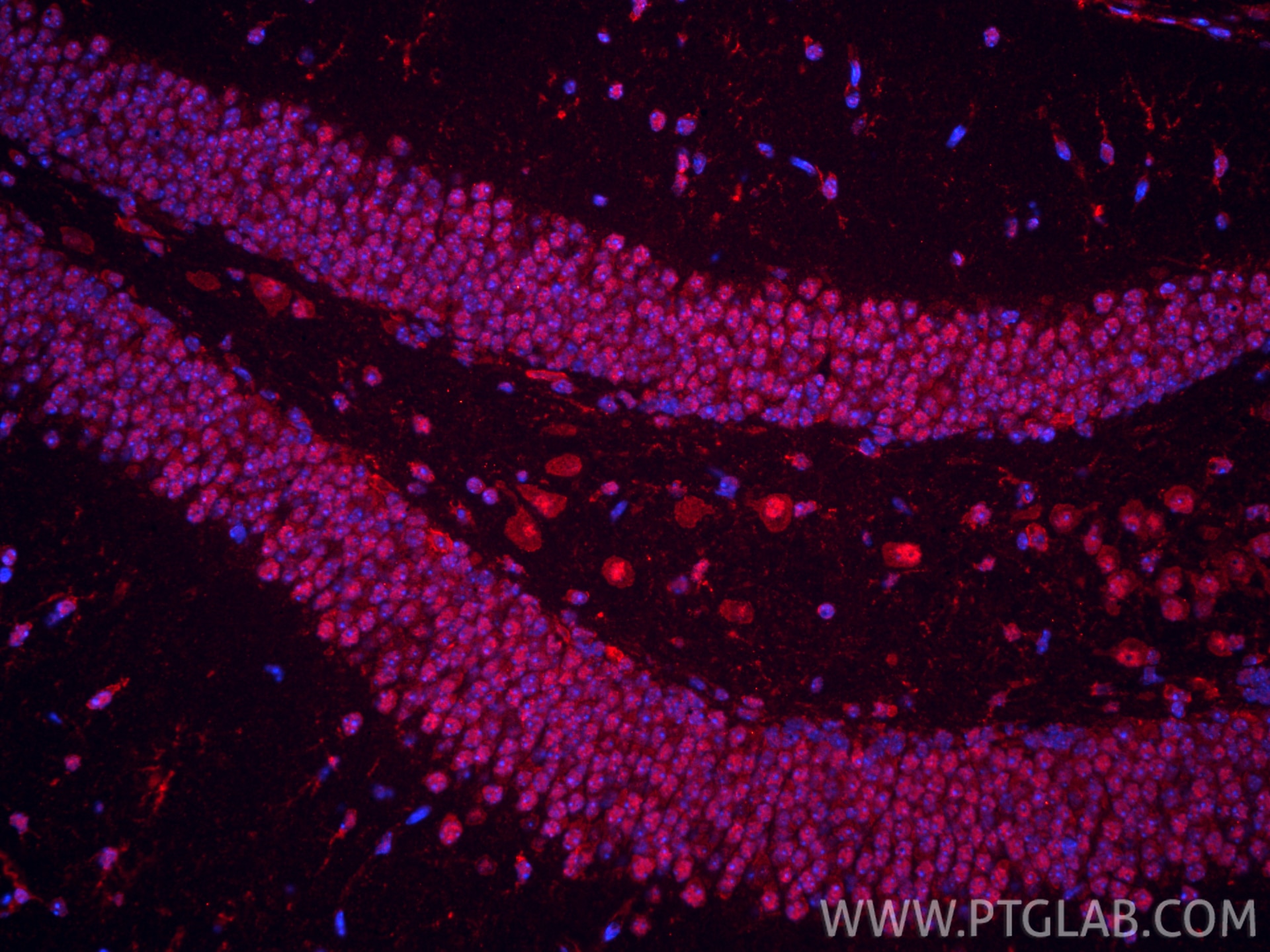 Immunofluorescence (IF) / fluorescent staining of mouse brain tissue using CoraLite®594-conjugated Glucocorticoid receptor Mo (CL594-66904)