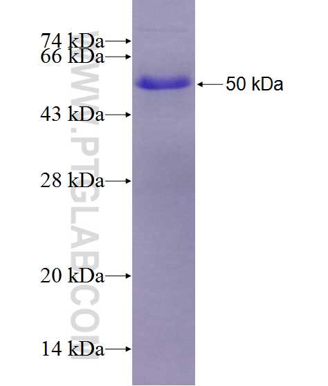 Glucocorticoid receptor fusion protein Ag28431 SDS-PAGE