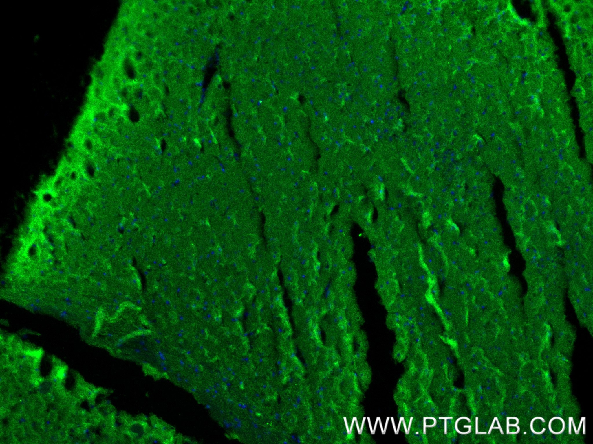 Immunofluorescence (IF) / fluorescent staining of mouse brain tissue using Glutamate receptor 3/GluA3 Recombinant antibody (84885-4-RR)