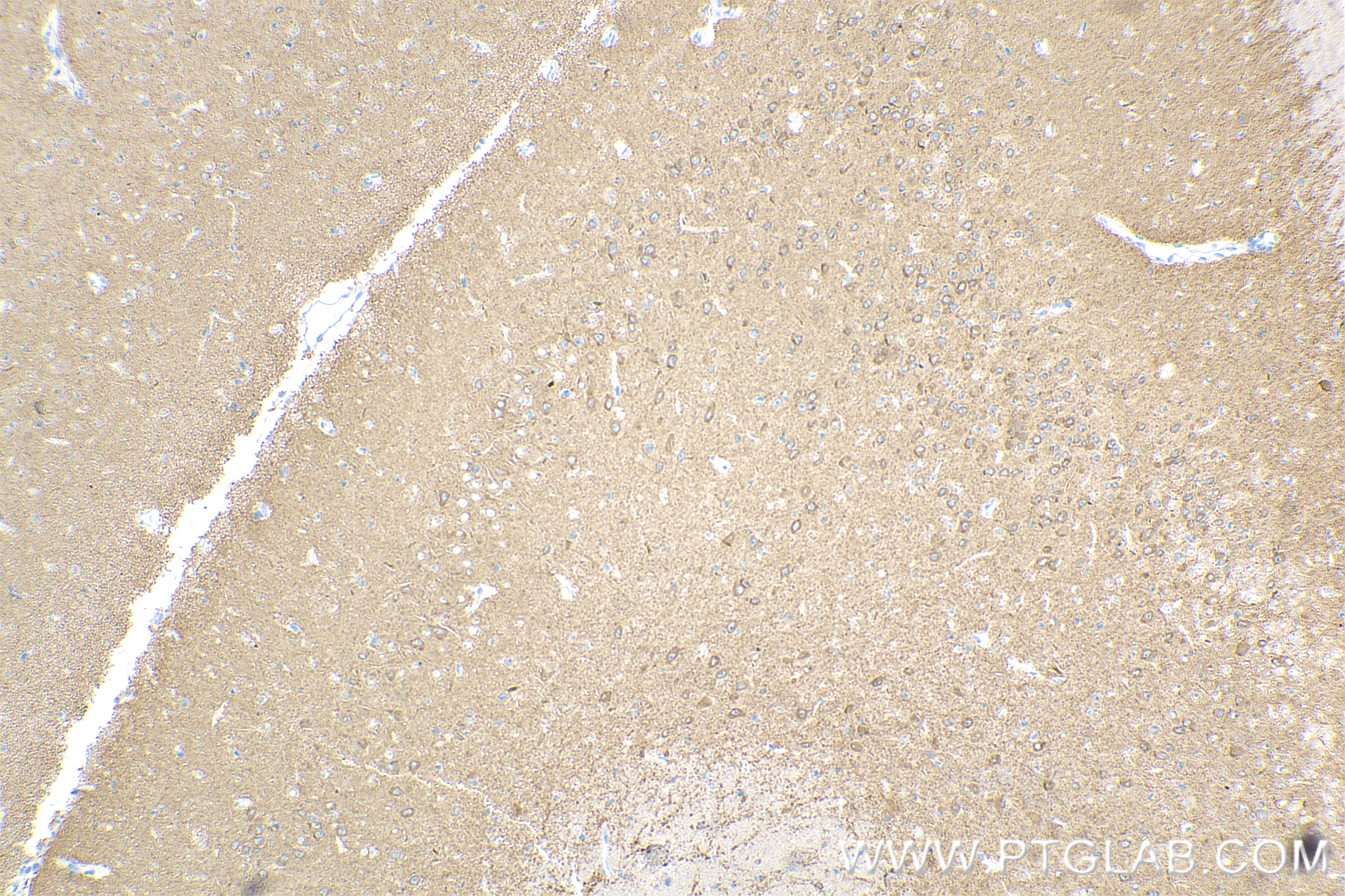 Immunohistochemistry (IHC) staining of mouse brain tissue using Glutamate receptor 3/GluA3 Recombinant antibody (84885-4-RR)