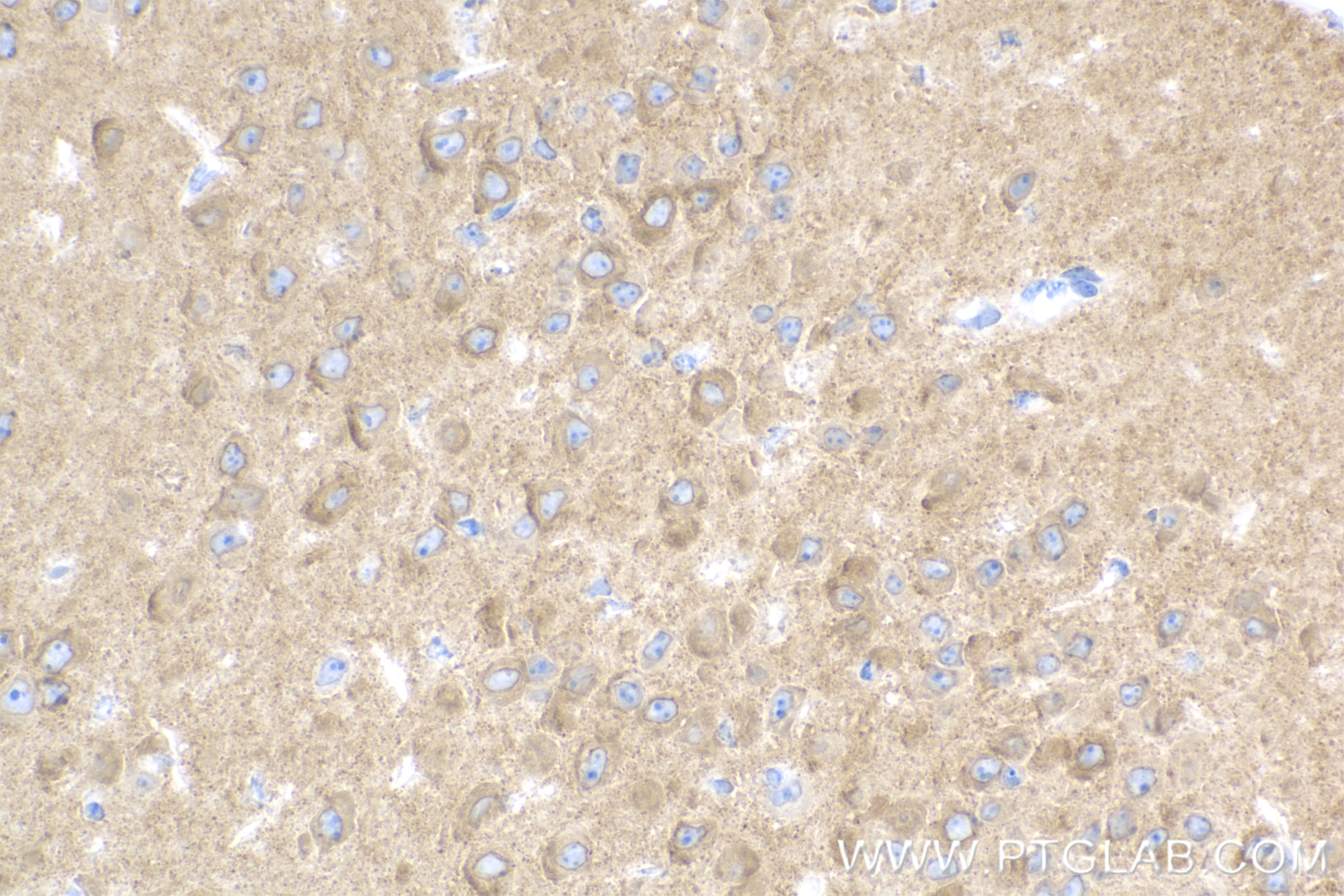 Immunohistochemistry (IHC) staining of mouse brain tissue using Glutamate receptor 3/GluA3 Recombinant antibody (84885-4-RR)