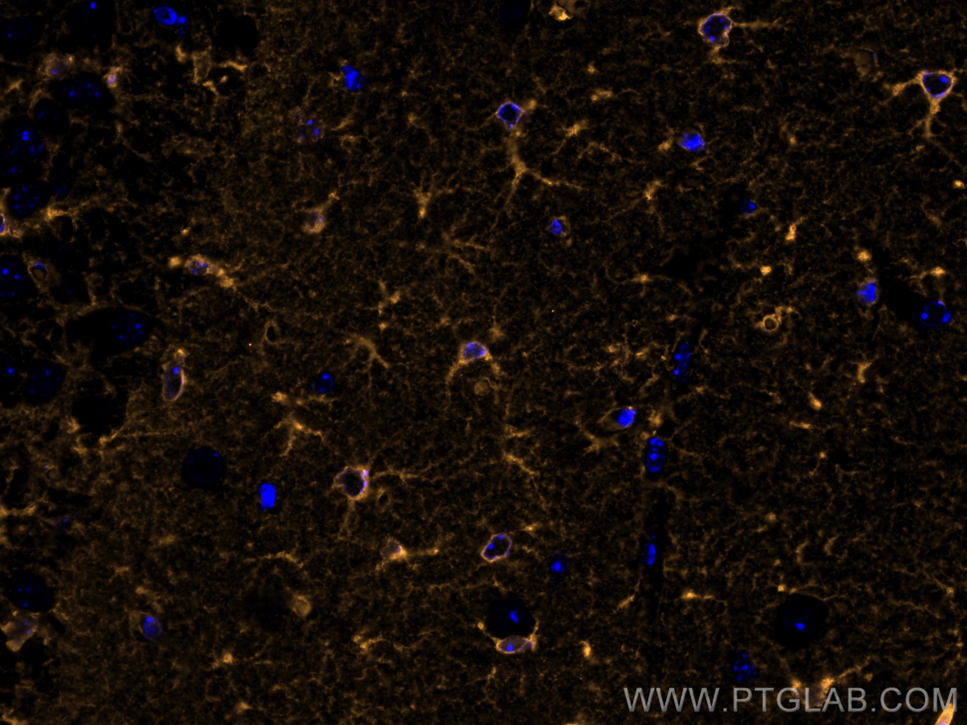 Immunofluorescence (IF) / fluorescent staining of mouse brain tissue using CoraLite®555-conjugated Glutamine Synthetase Monoc (CL555-66323)