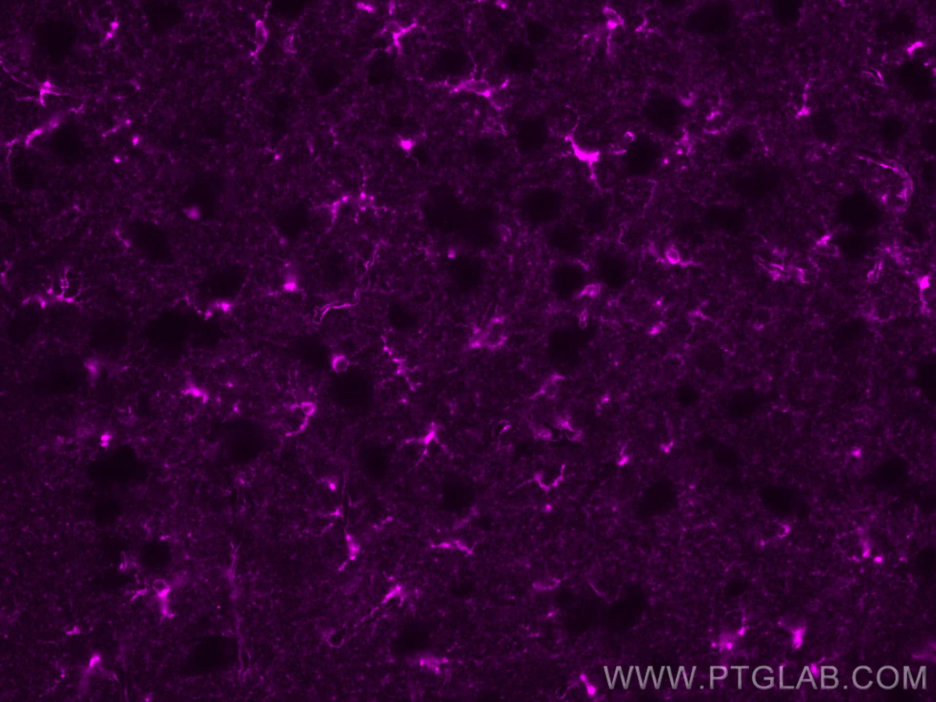 Immunofluorescence (IF) / fluorescent staining of mouse brain tissue using CoraLite® Plus 647-conjugated Glutamine Synthetase (CL647-66323-2)