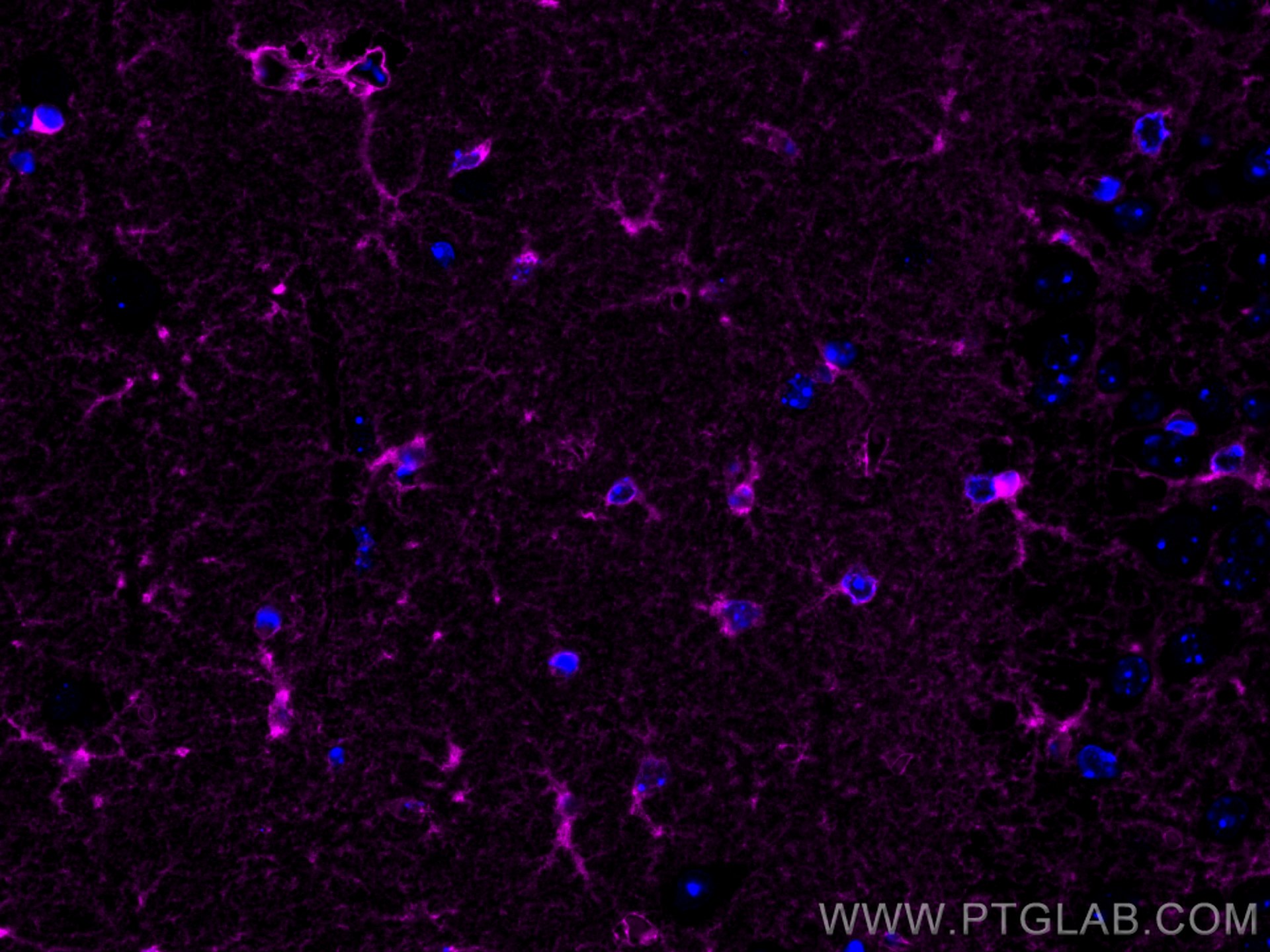 Glutamine Synthetase