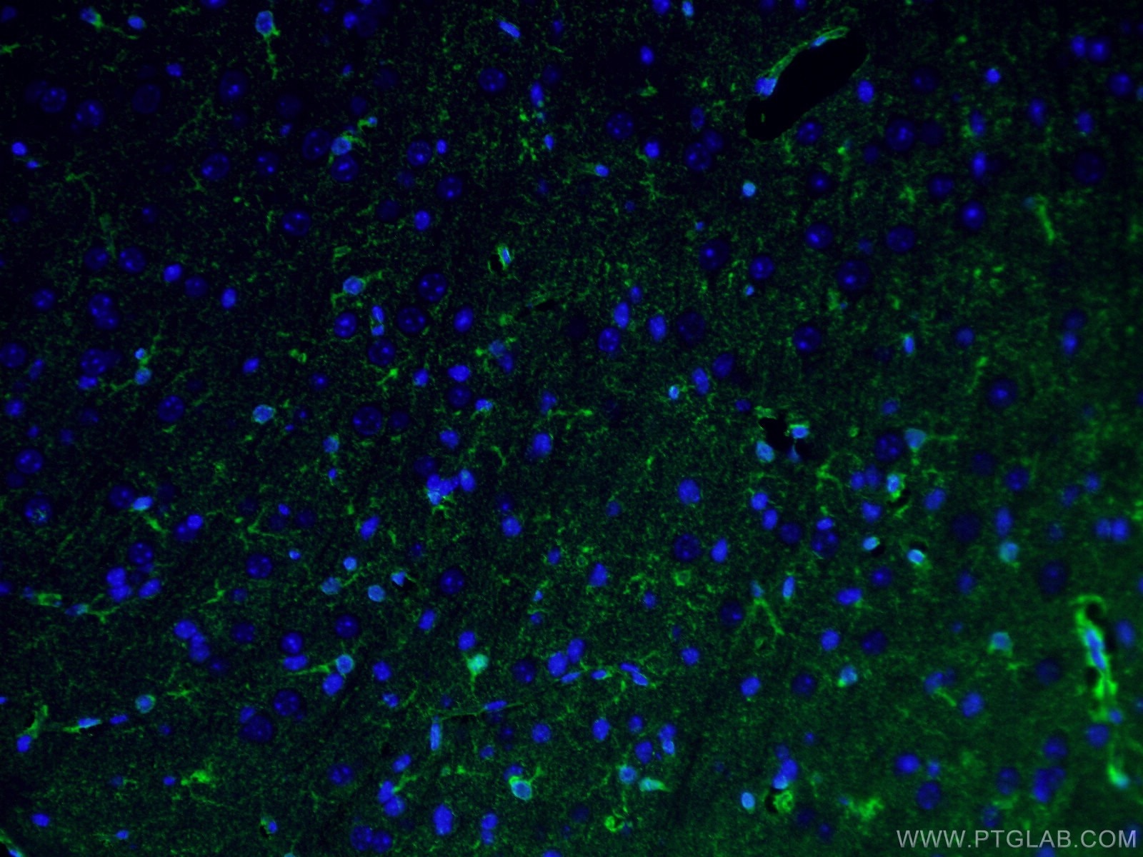 Immunofluorescence (IF) / fluorescent staining of human brain tissue using Glutamine Synthetase Monoclonal antibody (66323-1-Ig)