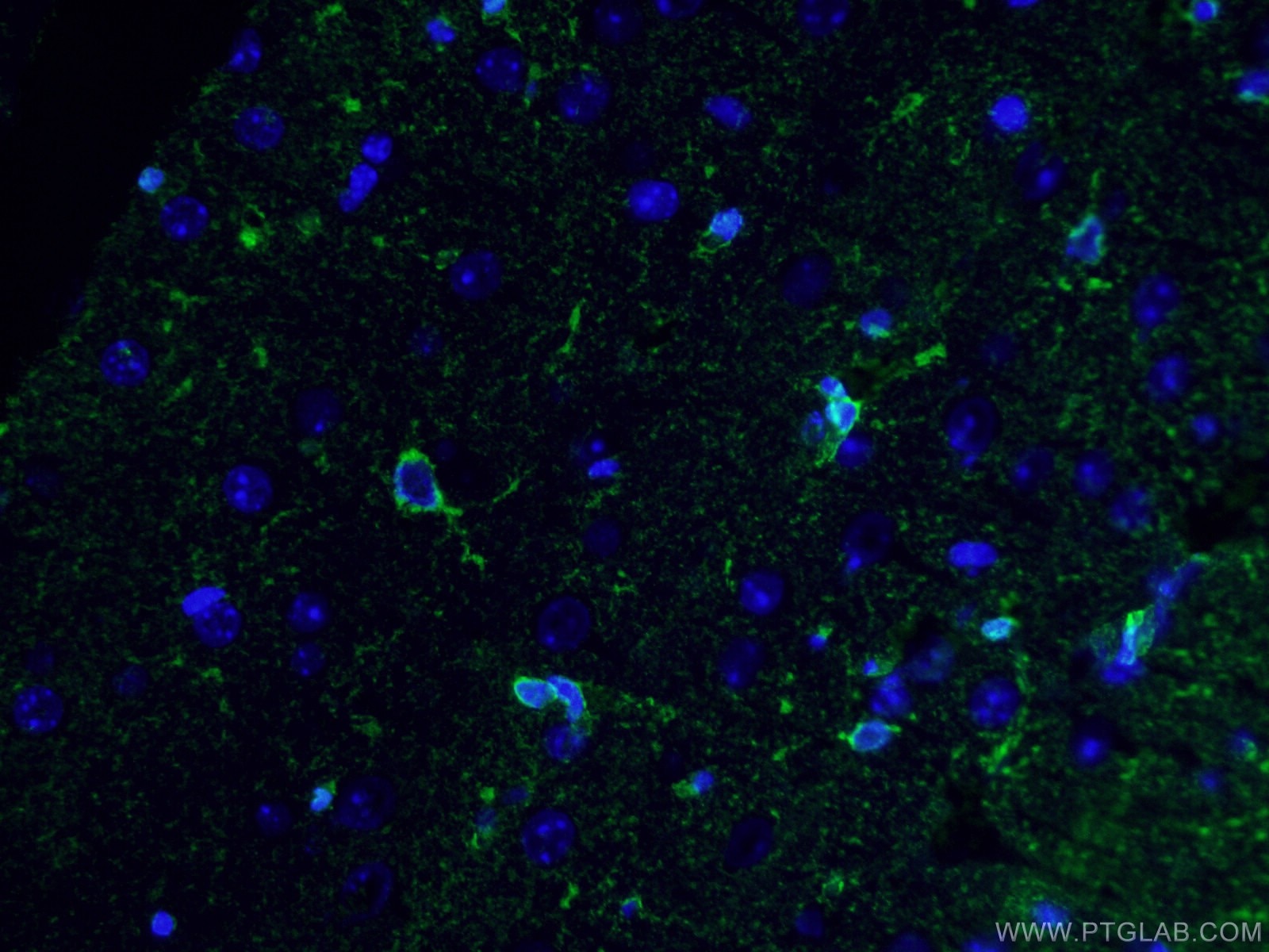 Immunofluorescence (IF) / fluorescent staining of human brain tissue using Glutamine Synthetase Monoclonal antibody (66323-1-Ig)