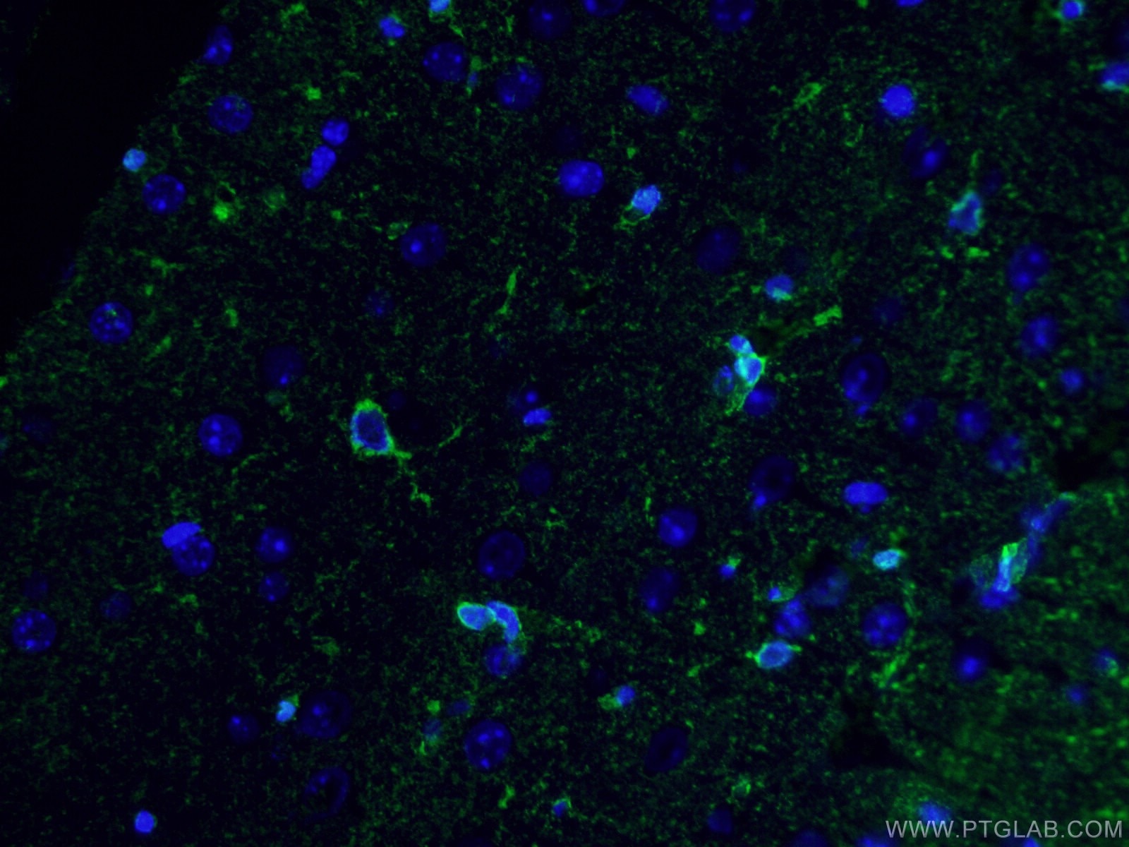 IF Staining of human brain using 66323-1-Ig