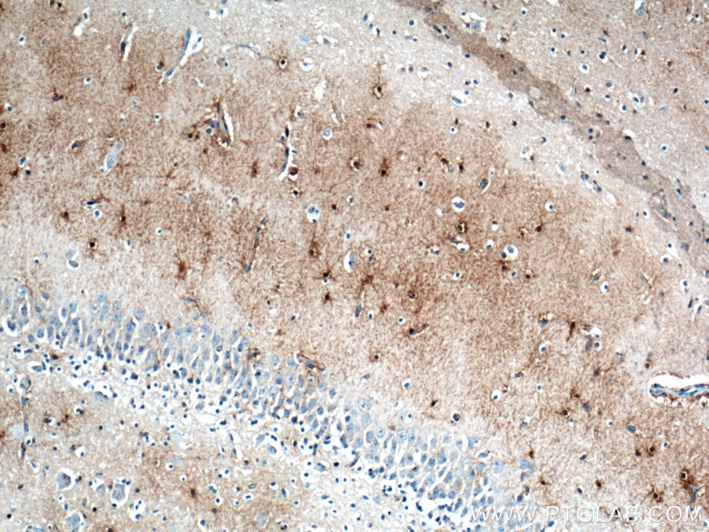 Immunohistochemistry (IHC) staining of human brain tissue using Glutamine Synthetase Monoclonal antibody (66323-1-Ig)