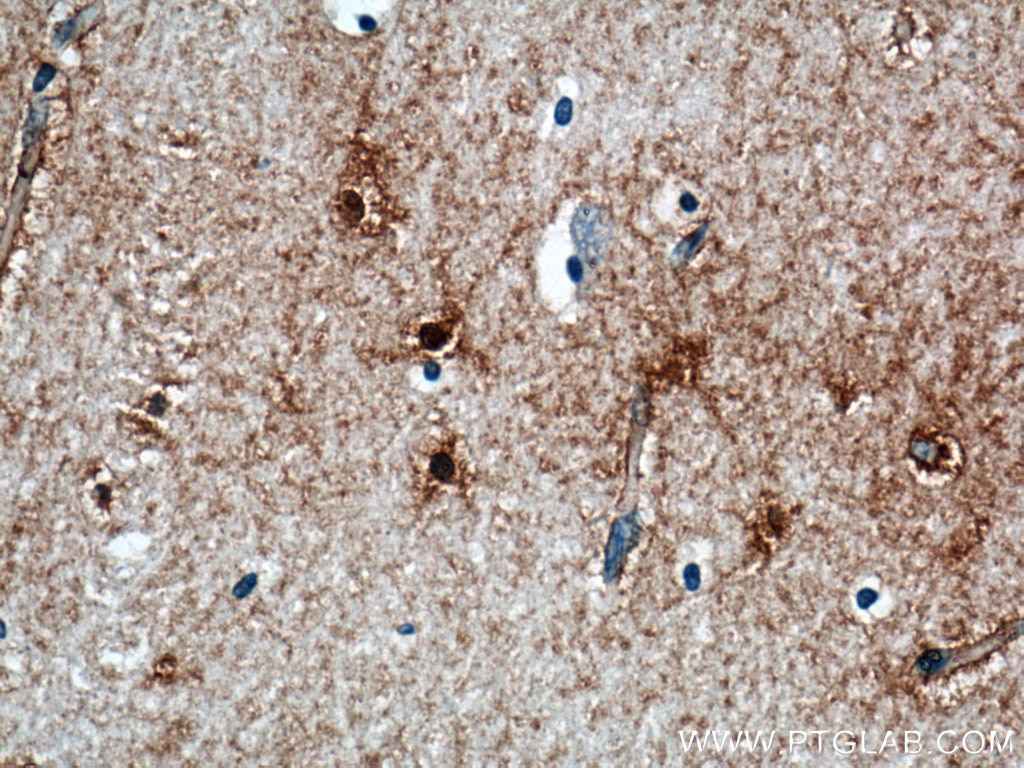 Immunohistochemistry (IHC) staining of human brain tissue using Glutamine Synthetase Monoclonal antibody (66323-1-Ig)