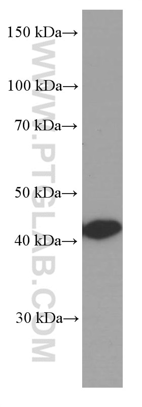 Western Blot (WB) analysis of Jurkat cells using Glutamine Synthetase Monoclonal antibody (66323-1-Ig)
