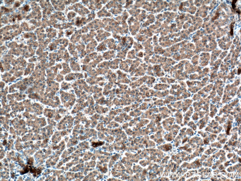 Glutamine Synthetase