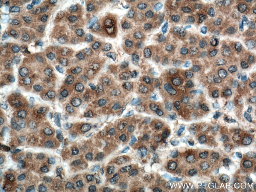Glutamine Synthetase