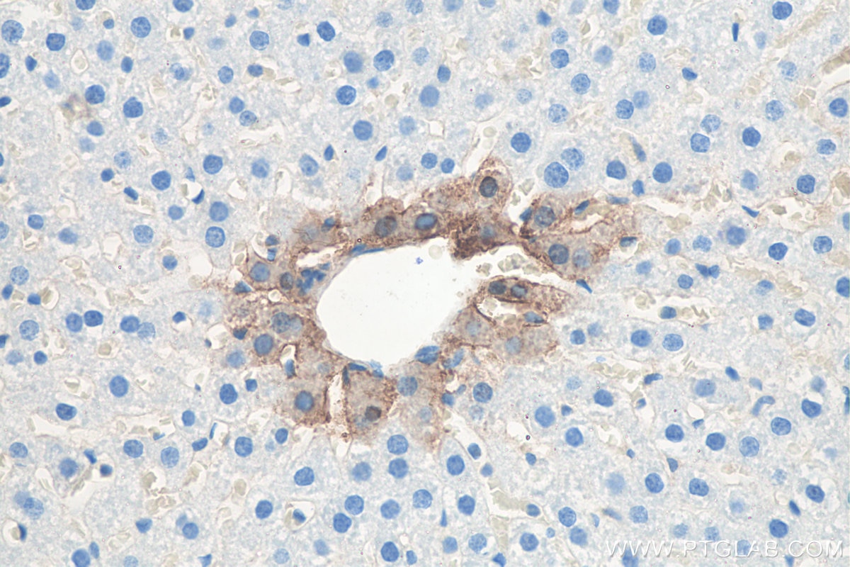 Immunohistochemistry (IHC) staining of rat liver tissue using Glutamine Synthetase Monoclonal antibody (66323-2-Ig)