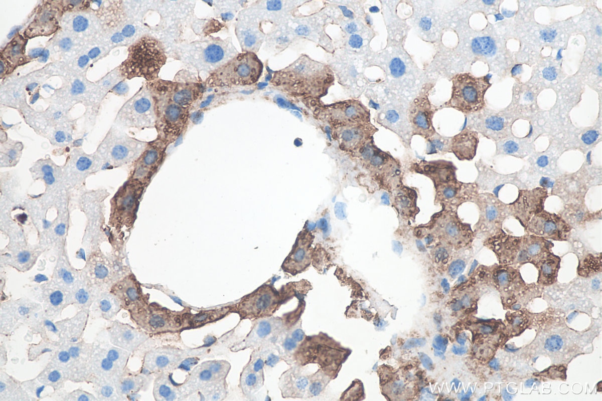 IHC staining of mouse liver using 66323-2-Ig