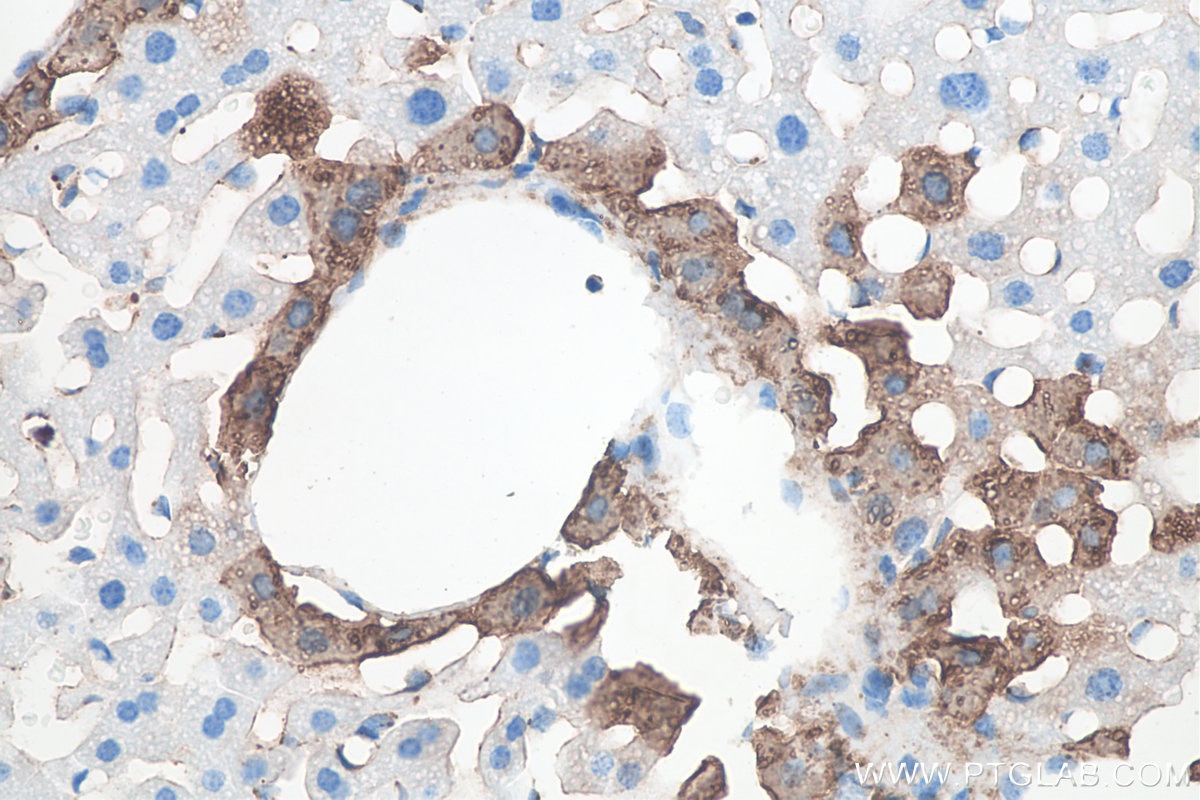 Immunohistochemistry (IHC) staining of mouse liver tissue using Glutamine Synthetase Monoclonal antibody (66323-2-Ig)