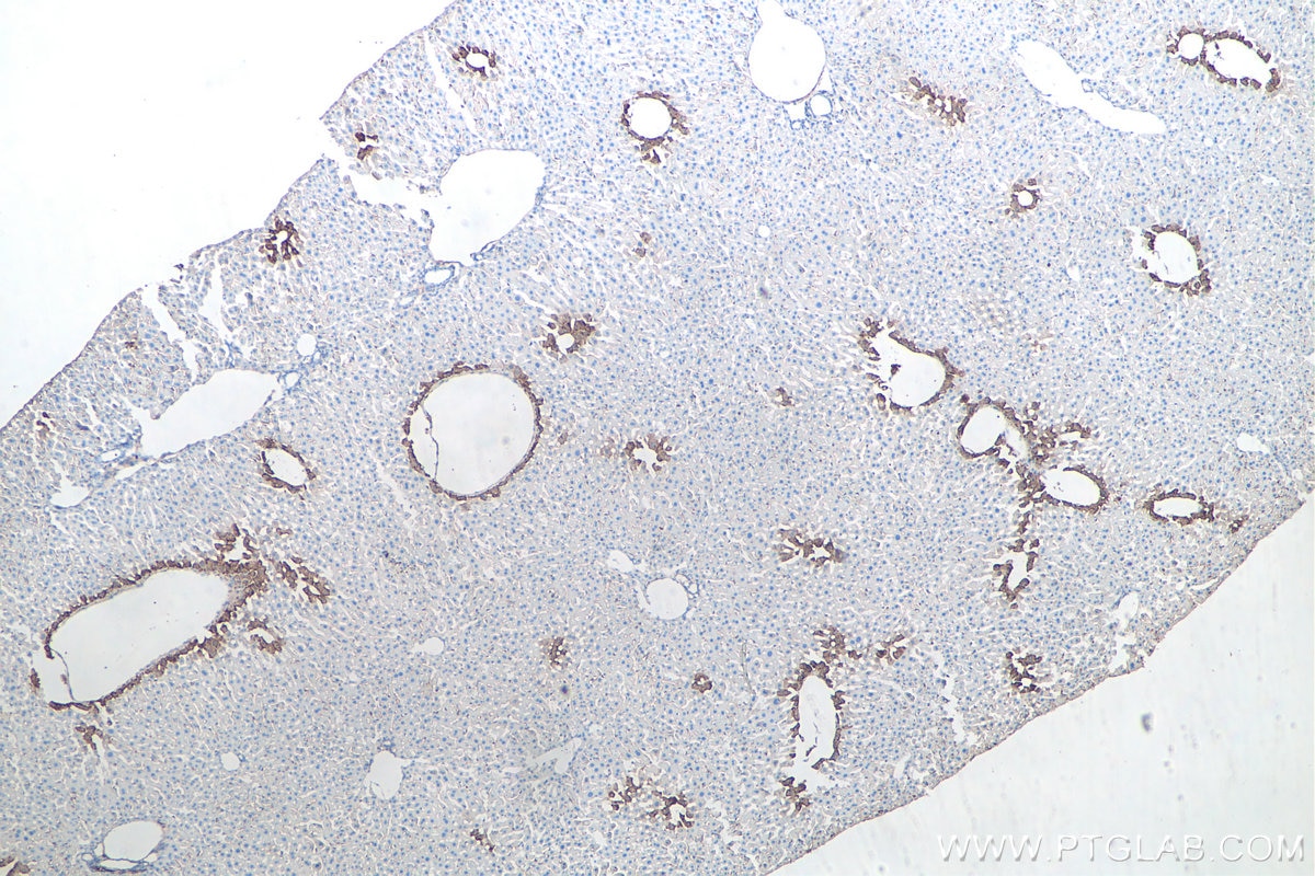 Immunohistochemistry (IHC) staining of mouse liver tissue using Glutamine Synthetase Monoclonal antibody (66323-2-Ig)