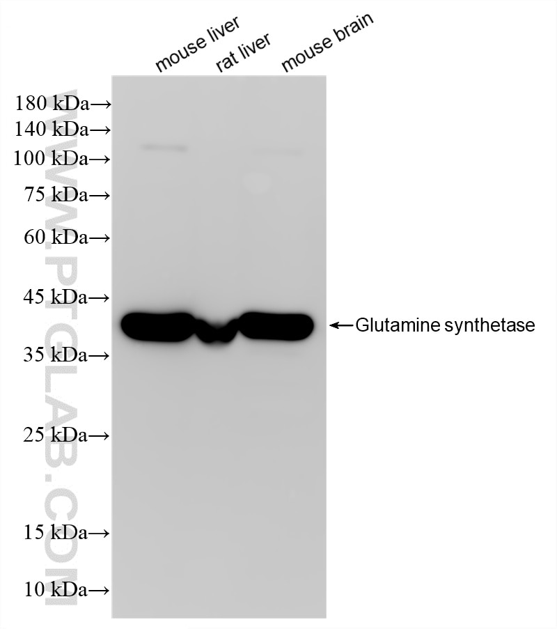 WB analysis using 86716-1-RR Western Blot (WB) analysis of various lysates using Glutamine synthetase Recombinant monoclonal antibo (86716-1-RR)