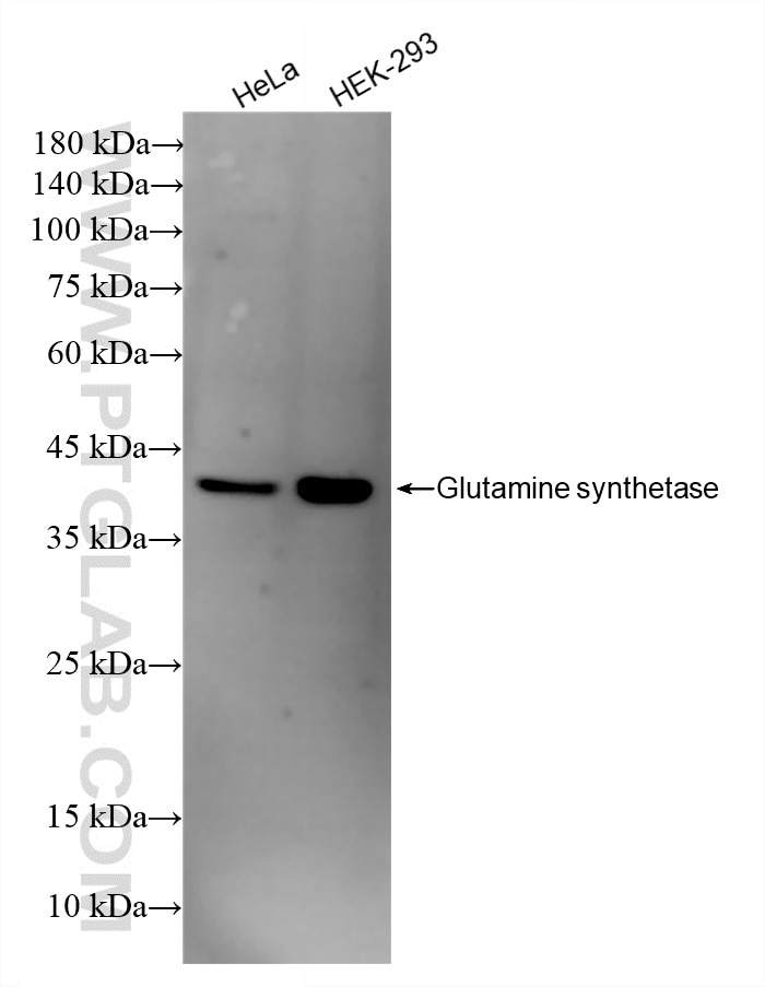 WB analysis using 86716-1-RR Western Blot (WB) analysis of various lysates using Glutamine synthetase Recombinant monoclonal antibo (86716-1-RR)