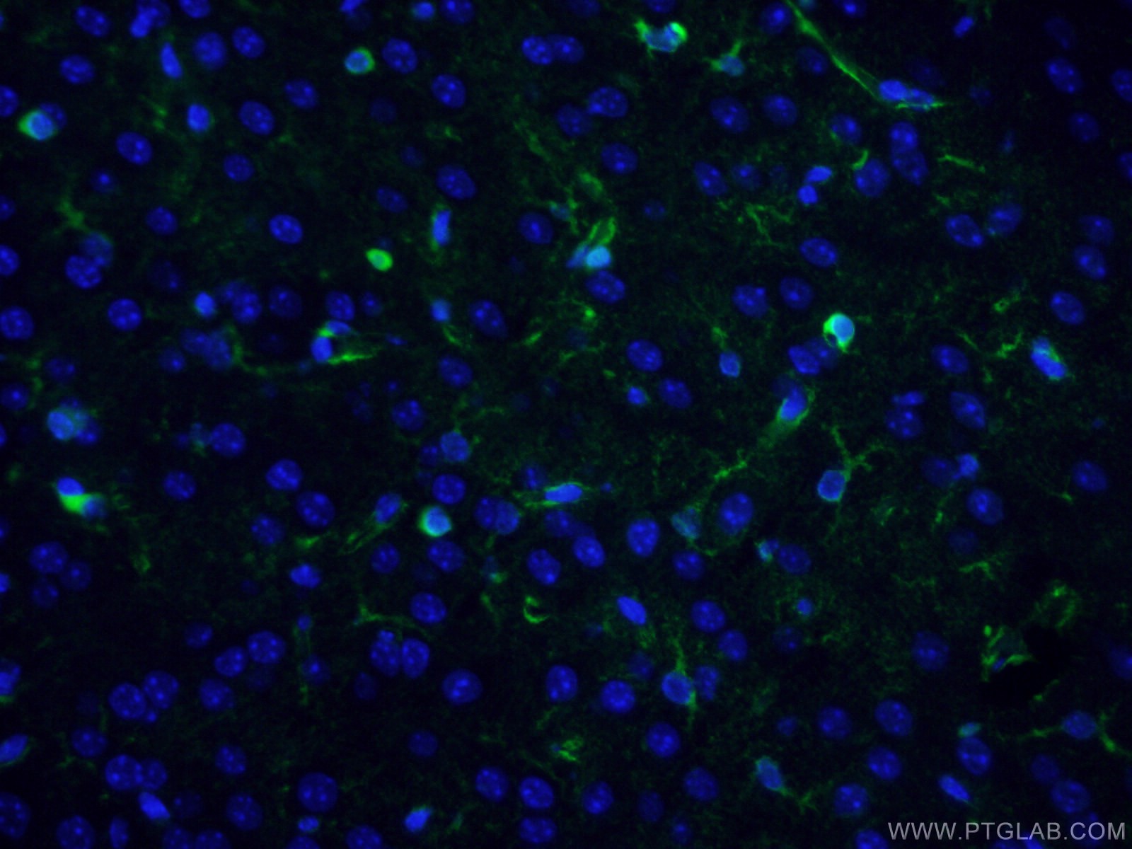 Immunofluorescence (IF) / fluorescent staining of mouse brain tissue using CoraLite® Plus 488-conjugated Glutamine Synthetase (CL488-66323)