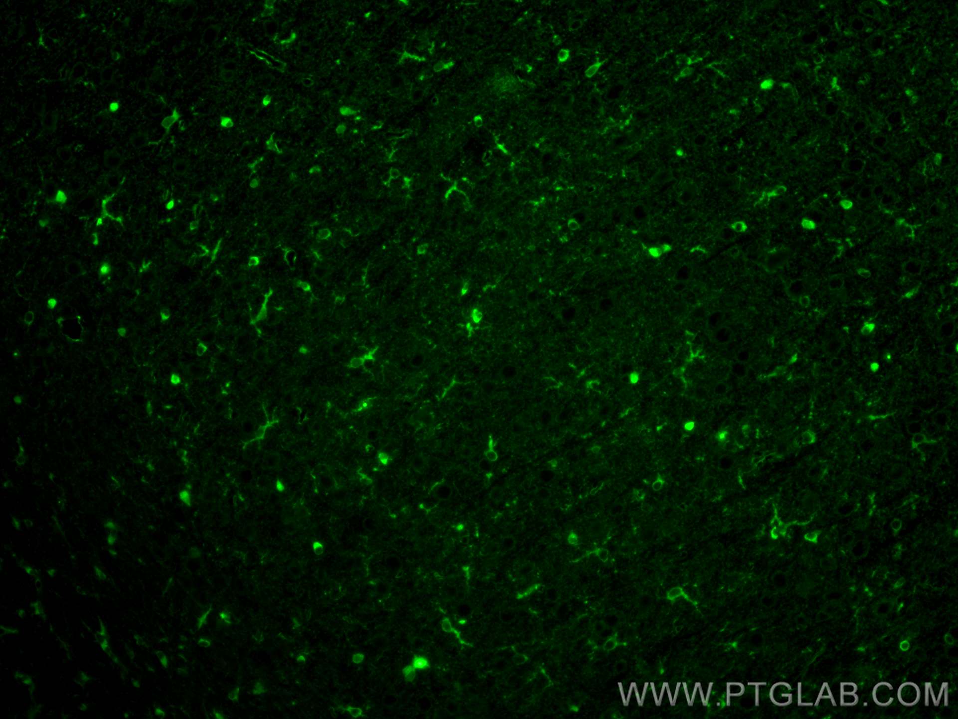 IF Staining of mouse brain using CL488-66323 Immunofluorescence (IF) / fluorescent staining of mouse brain tissue using CoraLite® Plus 488-conjugated Glutamine Synthetase (CL488-66323)