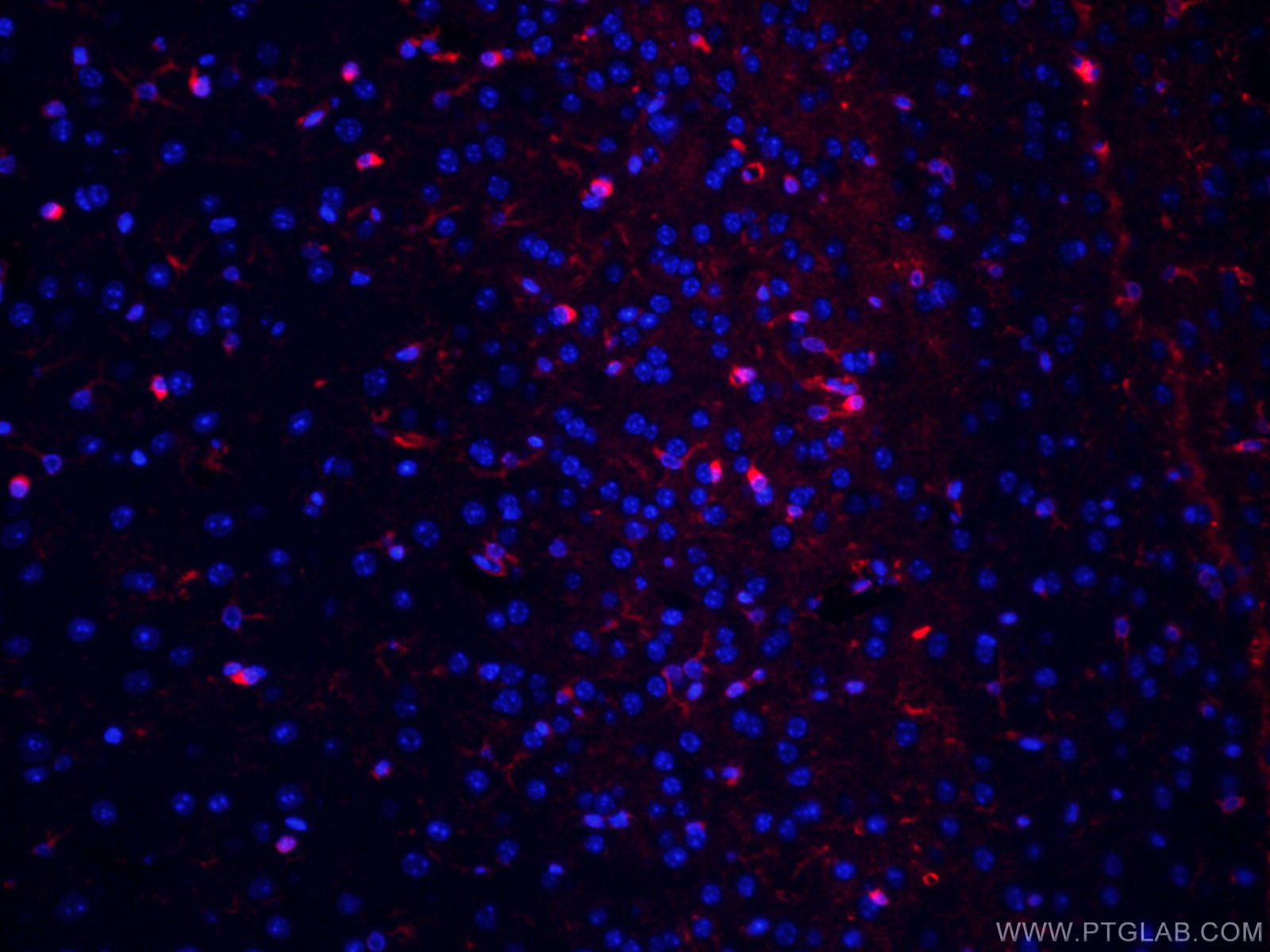 Glutamine Synthetase