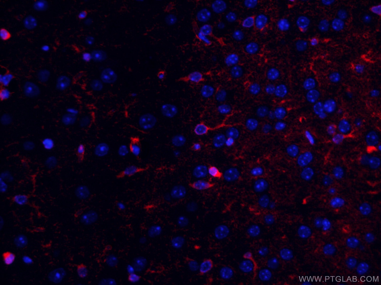 Glutamine Synthetase