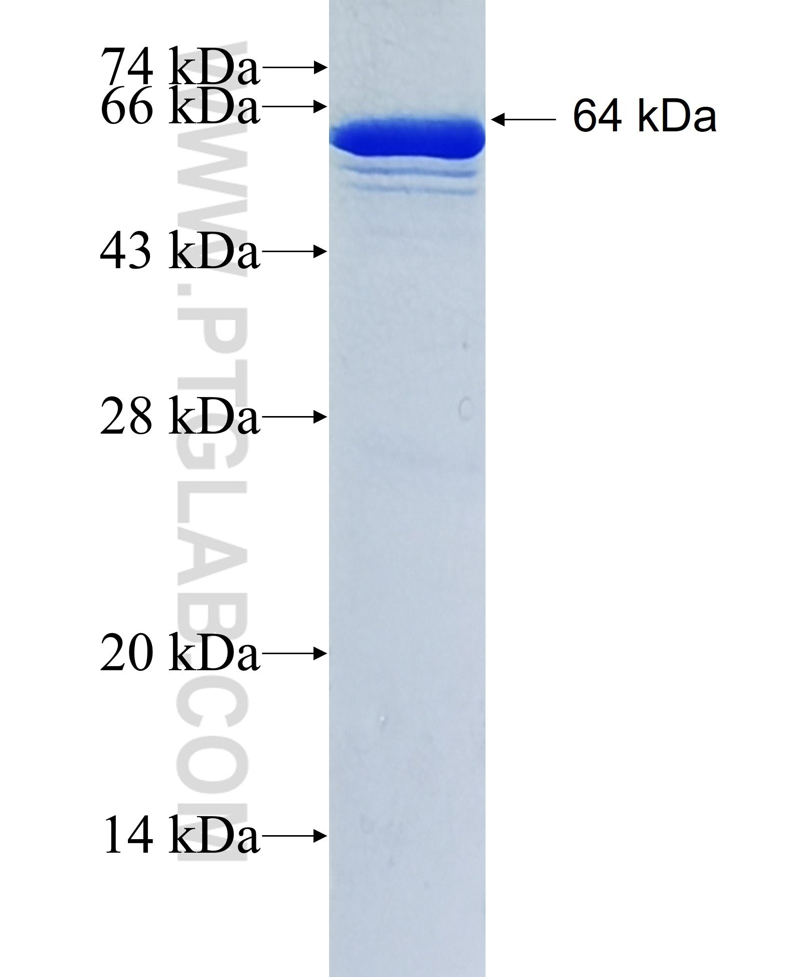 Glutamine synthetase fusion protein Ag1510 SDS-PAGE