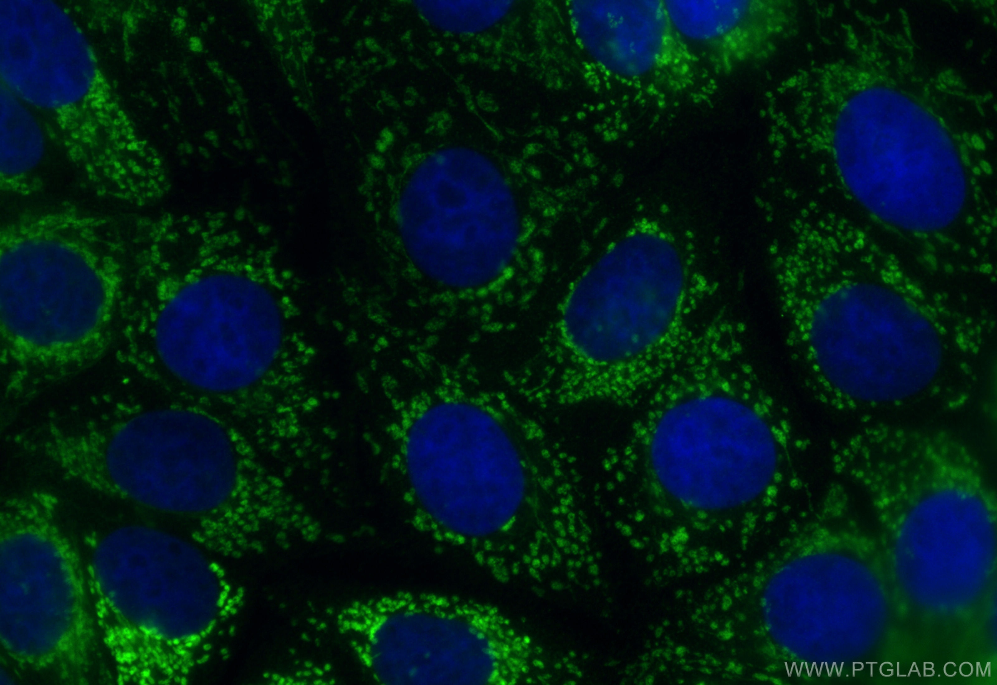 Immunofluorescent analysis of (4% PFA) fixed MCF-7 cells using CoraLite® Plus 488 Glutaredoxin 5 antibody (CL488-18884) at dilution of 1:200. Immunofluorescence (IF) / fluorescent staining of MCF-7 cells using CoraLite® Plus 488-conjugated Glutaredoxin 5 Polyc (CL488-18884)