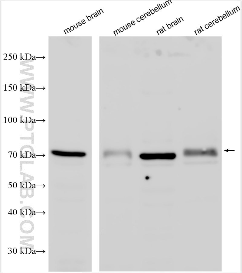 Western Blot (WB) analysis of various lysates using GlyT2 Polyclonal antibody (25948-1-AP)