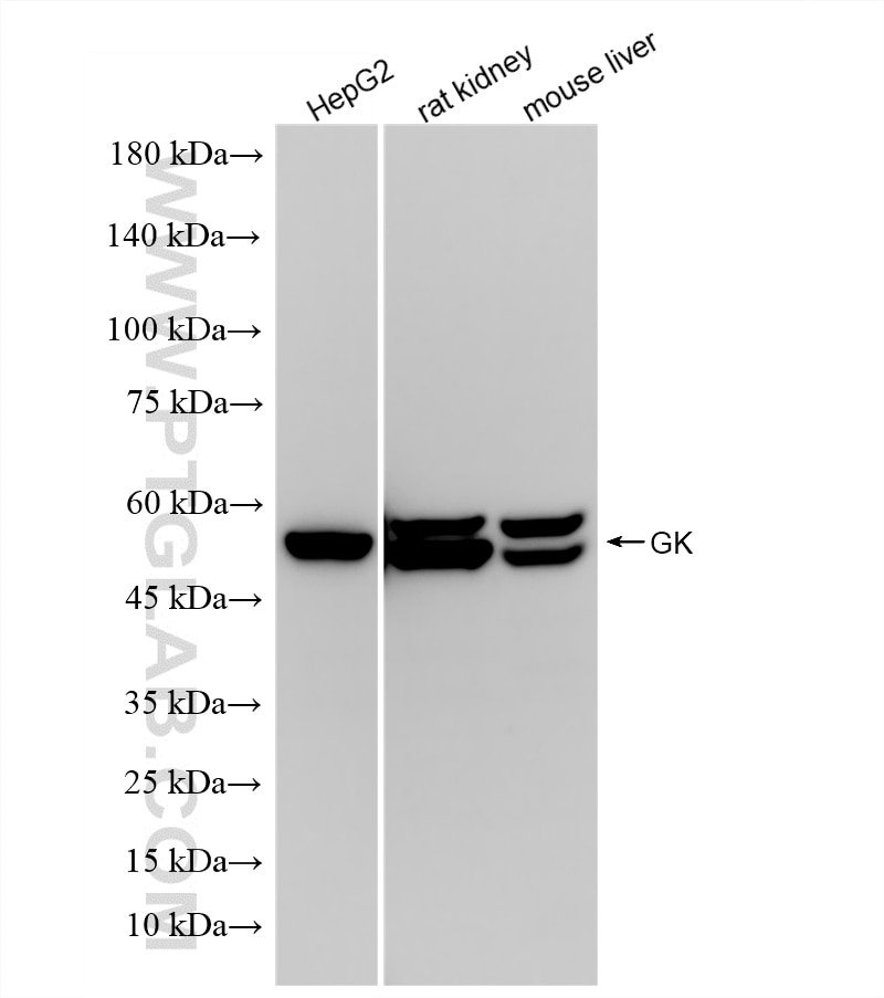 Western Blot (WB) analysis of various lysates using Glycerokinase Recombinant monoclonal antibody (86604-3-RR)