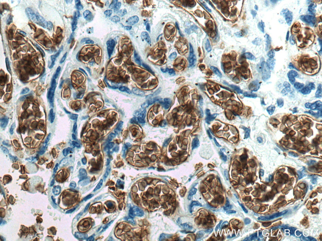 IHC staining of human placenta using 66778-1-Ig