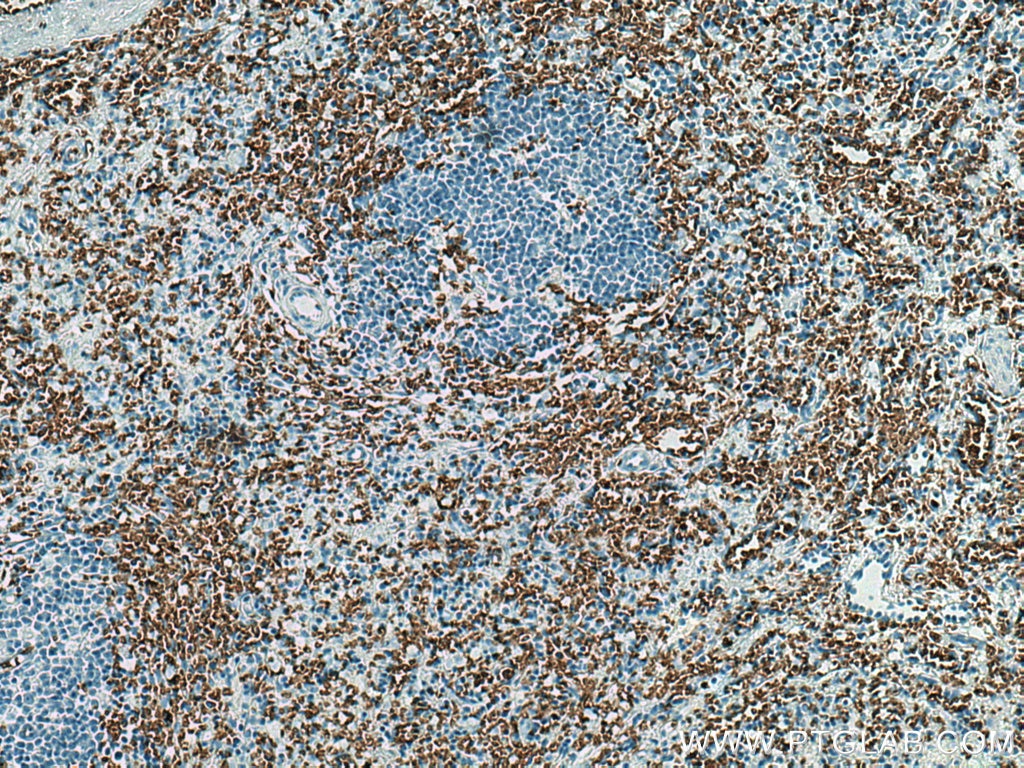 IHC staining of human spleen using 66778-1-Ig