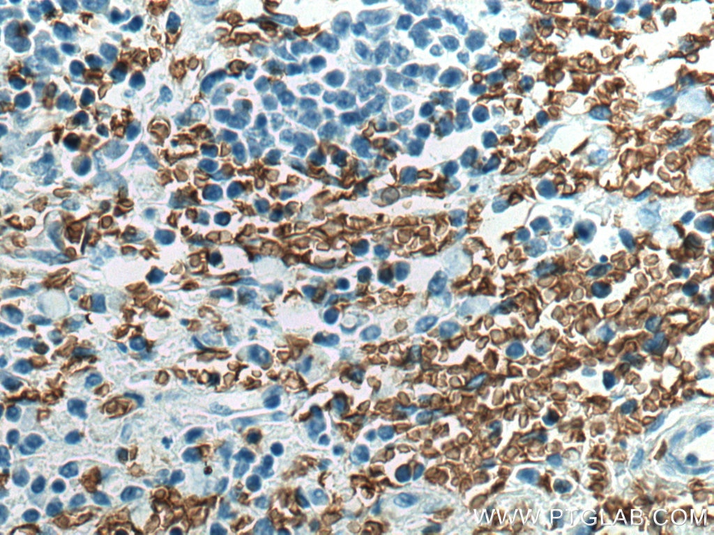 Immunohistochemistry (IHC) staining of human spleen tissue using Glycophorin A  Monoclonal antibody (66778-1-Ig)