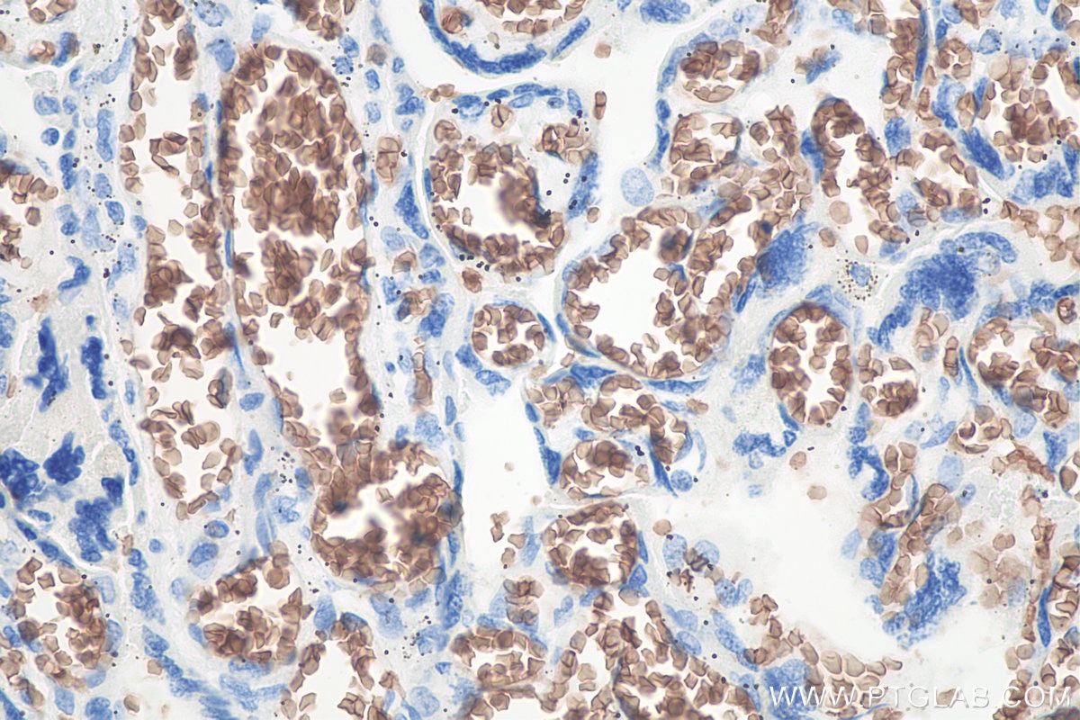 IHC staining of human placenta using 66778-1-Ig Immunohistochemistry (IHC) staining of human placenta tissue using Glycophorin A/CD235a Monoclonal antibody (66778-1-Ig)